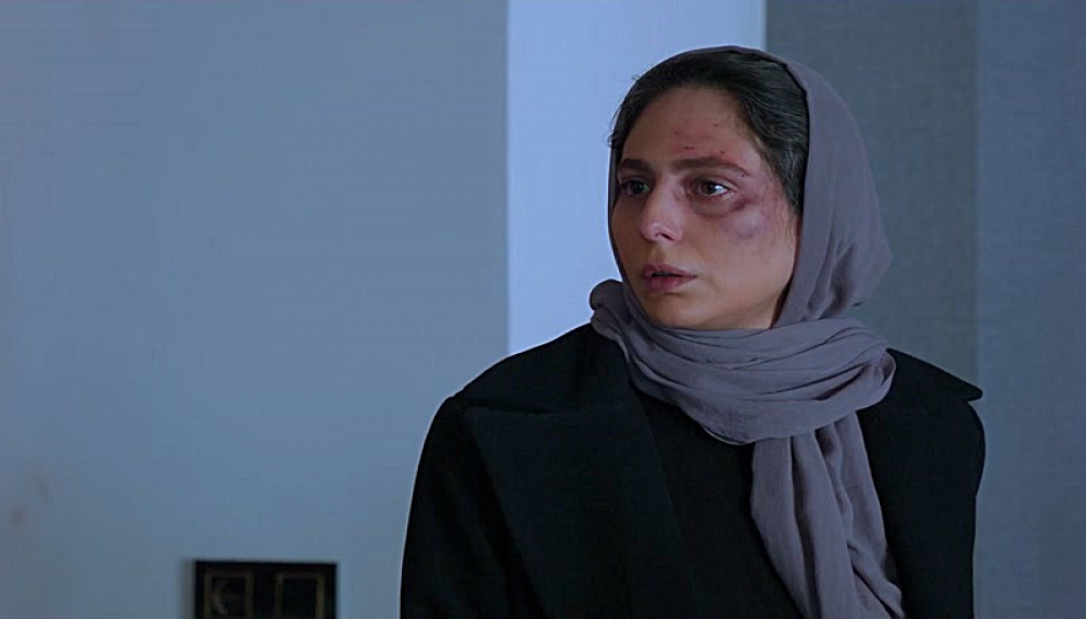 Derin Yara - Sezon 1 B&ouml;l&uuml;m 15